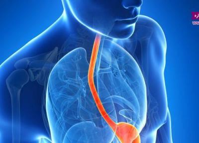 علائم رفلاکس معده چیست و چگونه درمان می شود؟